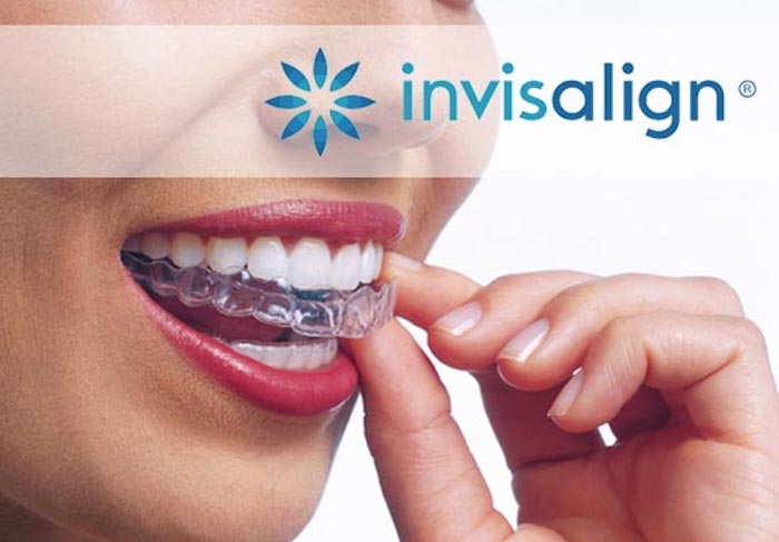 Treatment with Invisalign in Mexico