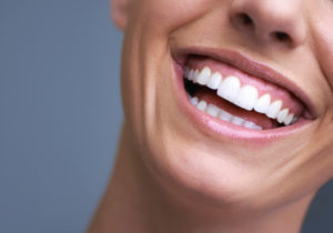 Smile Makeover | Dental Image