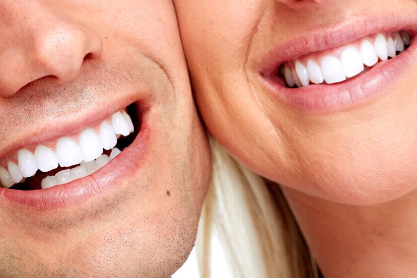 Dental Implants in Mexico