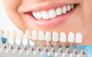 How Much Are Dental Implants in Tijuana? | Dental Image
