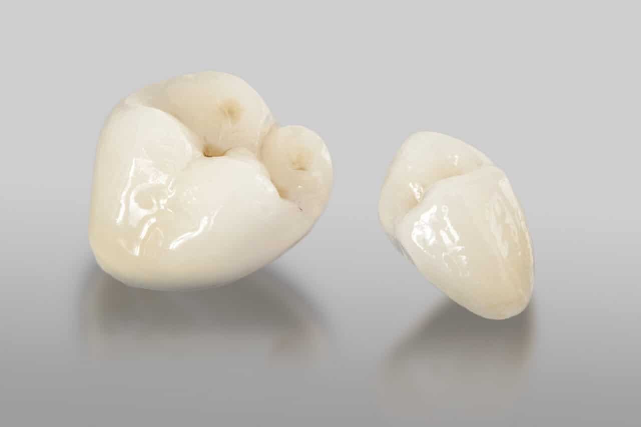 diente de porcelana precio