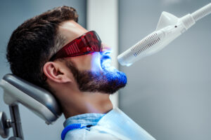 mejor tratamiento para blanquear los dientes