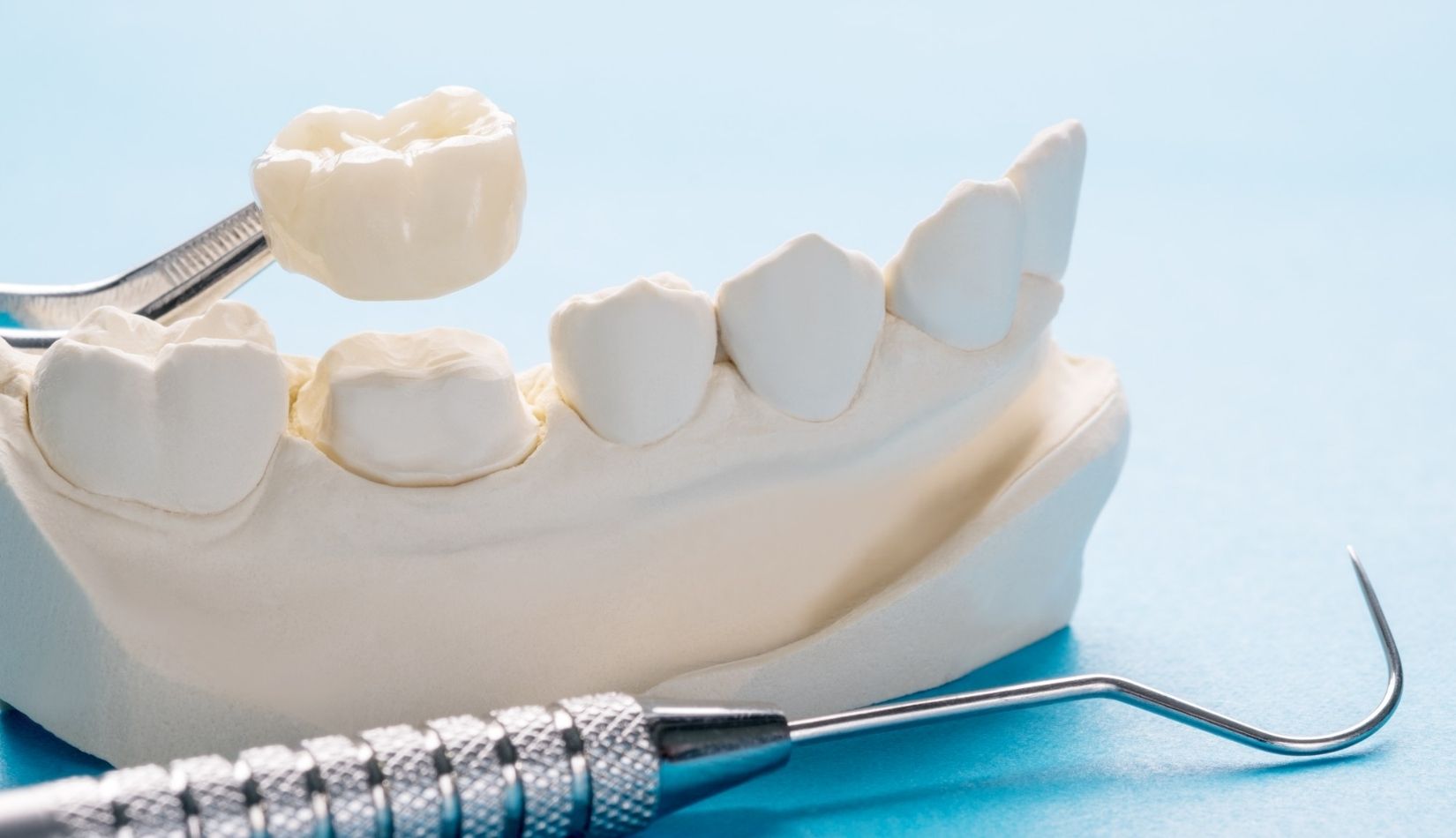 dental crowns in mexico