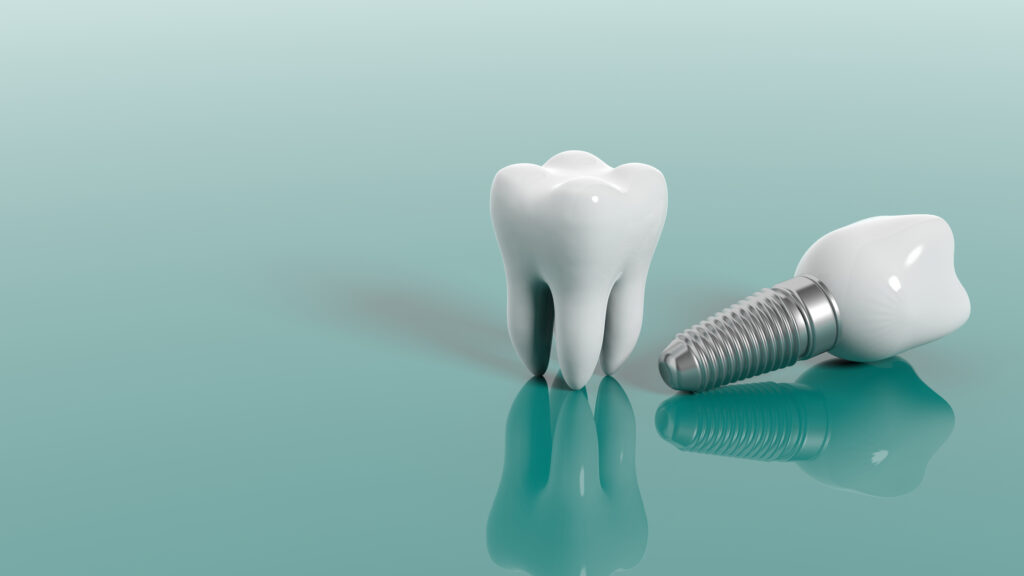 implante dental en mexico 2023