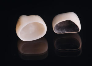 que es mejor dientes de zirconio o de porcelana